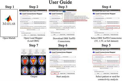 A Functional Connectome of Parkinson's Disease Patients Prior to Deep Brain Stimulation: A Tool for Disease-Specific Connectivity Analyses